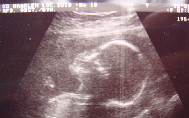 21weeks.jpg